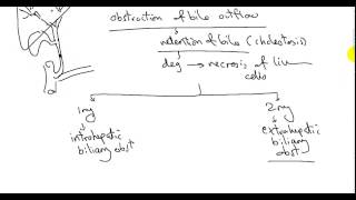 BILIARY CIRRHOSIS DR SAMEH GHAZY [upl. by Boonie]