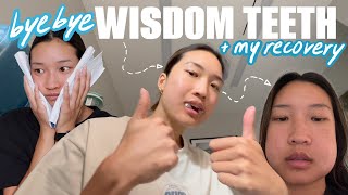 GETTING ALL MY WISDOM TEETH REMOVED surgery recovery vlog [upl. by Uriiah557]