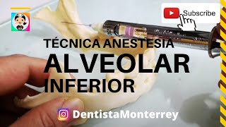 💉TÉCNICA ANESTESIA ALVEOLAR INFERIOR👅 PASO A PASO [upl. by Aissert588]