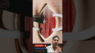 Tracheotomy process shorts trending animation satisfying 3danimation [upl. by Irby]