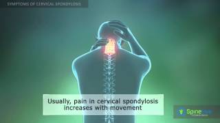 Cervical Spondylosis Symptoms [upl. by Anastasia989]