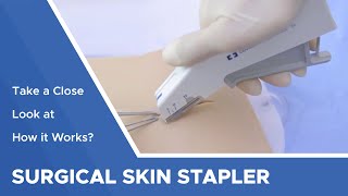 Surgical Skin Stapler Take a Close Look at How it Works [upl. by Pooley]