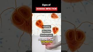 IBS Symptoms or Giardia Parasite Infection guthealth youtubeshorts shorts [upl. by Gudren]