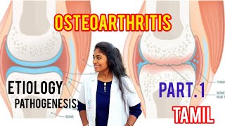 osteoarthritis  causespathophysiology clinical features part 1 in tamil [upl. by Rape]