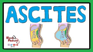 ASCITES  Serum Ascites Albumin Gradient SAAG  Ascites Pathophysiology  Ascites Causes [upl. by Hedy]