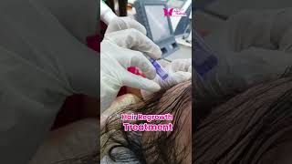 Want your hair back with hair regrowth treatment [upl. by Tesler985]