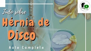 Tudo sobre Hernia de disco  Aula Completa [upl. by Ergener681]