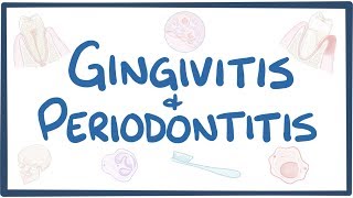 Gingivitis and periodontitis  causes symptoms diagnosis treatment pathology [upl. by Onid]