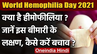 World Hemophilia Day 2021 क्या है हीमोफीलिया जानें इस बीमारी के लक्षण और बचाव   वनइंडिया हिंदी [upl. by Calendra]