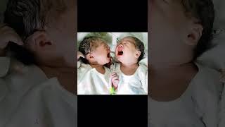 Twins baby crying together [upl. by Elson]