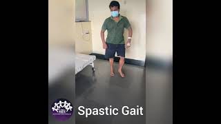 SPASTIC GAIT [upl. by Chimene]