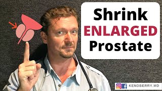 Shrink ENLARGED PROSTATE in 7 Easy Steps 2024 Update [upl. by Aserahs]