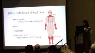 Dr Carla Grosmann  Myotonic Dystrophy An Overview [upl. by Campball749]