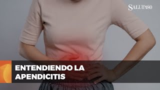 ✅ ¡Lo que debes saber sobre la APENDICITIS y cuidados postcirugía  Salud 180 🌿 [upl. by Dyer]