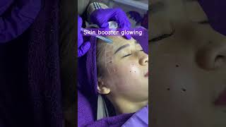 Skinbooster glowing [upl. by Granny]