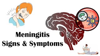 Meningitis  Signs amp Symptoms Most Common Signs amp Symptoms Of Meningitis [upl. by Calli]