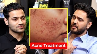 Pimple amp Acne Treatment  DO THIS  Dermatologist  Dr Gurjot Marwah  Raj Shamani Clips [upl. by Moore464]