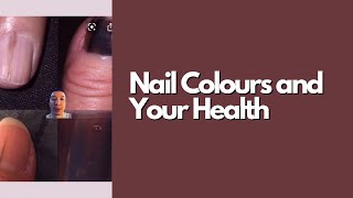 Nail Colour and Your Health [upl. by Palladin]