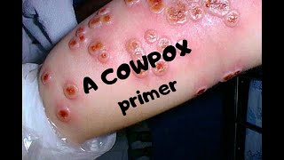 COWPOX A primer on a now rare infection [upl. by Novi]