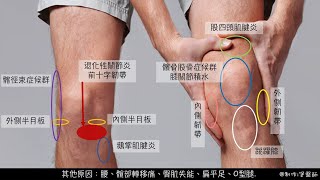 Know more knee pain了解更多膝蓋痛 國語版本 [upl. by Yarvis]