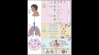 pneumonia vs tuberculosis  Medical Common Sense [upl. by Aytak]