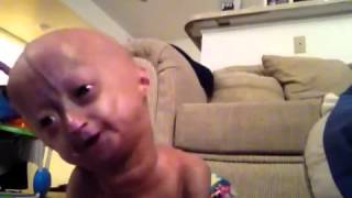 Adalia Rose  Signing jesus love me [upl. by Lyrac]