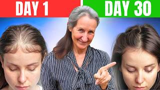 Barbara ONeills SHOCKING Hair Loss Discovery What They Hid From You [upl. by Ariait127]