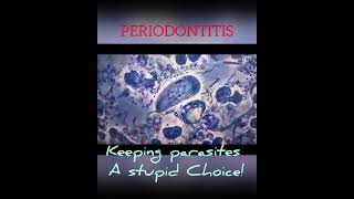 Periodontitis choice biology microscope Trichomonas tenax [upl. by Heyra88]