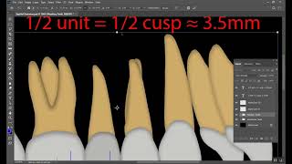 Classification of malocclusion Part 1 [upl. by Cos]