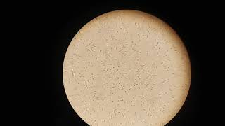 فى المعمل مباشرة عينة Normal mortility and good movment [upl. by Schechter]