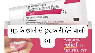 triamcinolone acetonide buccal pastetriamcinolone acetonide buccal paste uses in hindi [upl. by Zoller]