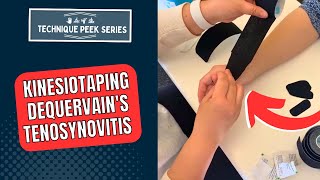 Kinesiotaping Technique for Treatment of DeQuervains Tenosynovitis  Technique Peek Series [upl. by Einna]