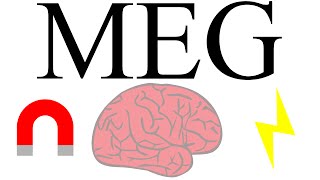 Magnetoencephalography measuring brain activity with magnetism [upl. by Dyol]