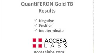 TB Blood Test QuantiFERON Gold TB Blood Test Results Overview [upl. by Nolyad285]