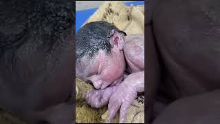 Vernix caseosaknown as vernix is the waxy white substance found coating the skin newborn human baby [upl. by Kress]