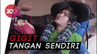 Penyakit Langka Bikin Bocah Ini Sering Menyakiti Diri Sendiri [upl. by Erodasi]