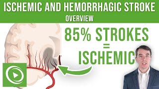 Overview of Ischemic and Hemorrhagic Stroke  Lecturio [upl. by Isia]