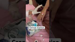 Cannula insertion of female patient shorts nurses mbbs neet mbbsstudnets doctor subscribe [upl. by Mchail]