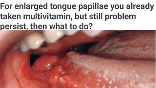 Tongue papillae enlarges you had taken multivitamin but not relieved yet then what are causes [upl. by Nefets]