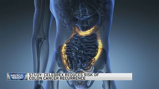 Study Celebrex reduces risk of colon cancer recurrence — and more [upl. by Kreda]