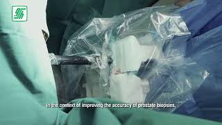 Targeted Prostate Biopsy using MRIUS fusion [upl. by Goraud]