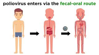 Poliomyelitis Poliovirus [upl. by Crawford]