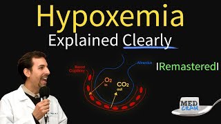 Hypoxemia  The 5 Causes amp Treatment 1 High Altitude [upl. by Anelis]