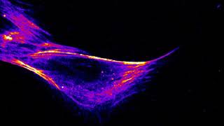 Inner Movement of the Cell  Actin Flux Visualised with SiRActin [upl. by Yeniar99]