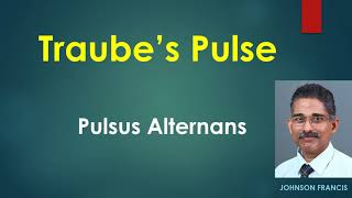 Traube’s Pulse – Pulsus Alternans [upl. by Aicnarf]