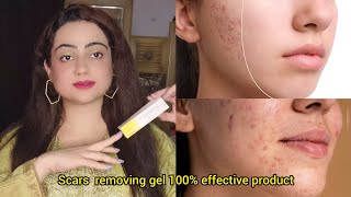 Acne scars removal Gel  contractubex Gel beauty facts acnescars scars pimples [upl. by Pubilis451]