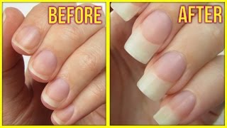 5 Ways to Grow Your Nails FAST [upl. by Poland]