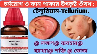 568quotটেলুরিয়ামquot চর্মরোগ ও কান পাকার উৎকৃষ্ট ঔষধ Tellurium best medicine skin amp earache diseases [upl. by Lirbaj]