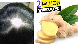 Ginger Juice to Cure Baldness amp Regrow New Hair  Sushmitas Diaries [upl. by Carry527]