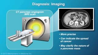 Pancreatic Cancer Pathophysiology Diagnosis and Staging [upl. by Akram]